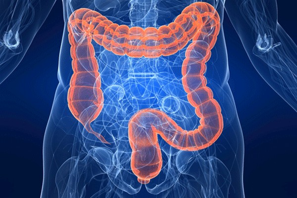 Risk Factors And Clinical Manifestations Ulcerative Colitis